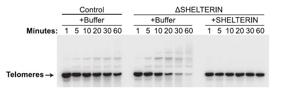 Telomere replication gel with control, Shelterin-depleted and Shelterin-supplemented conditions and their time points.